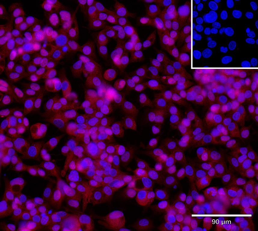 Ankyron DCTP1_HUMAN Clone CY40751