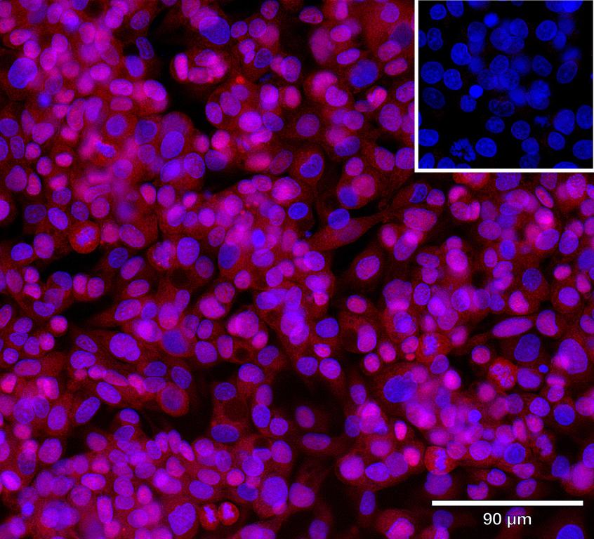 Ankyron DCTP1_HUMAN Clone CY40761