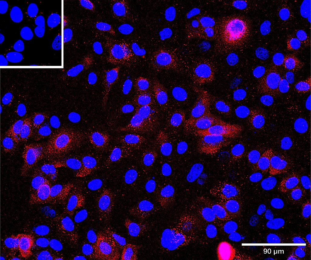 Ankyron DDR1_HUMAN Clone BI40146