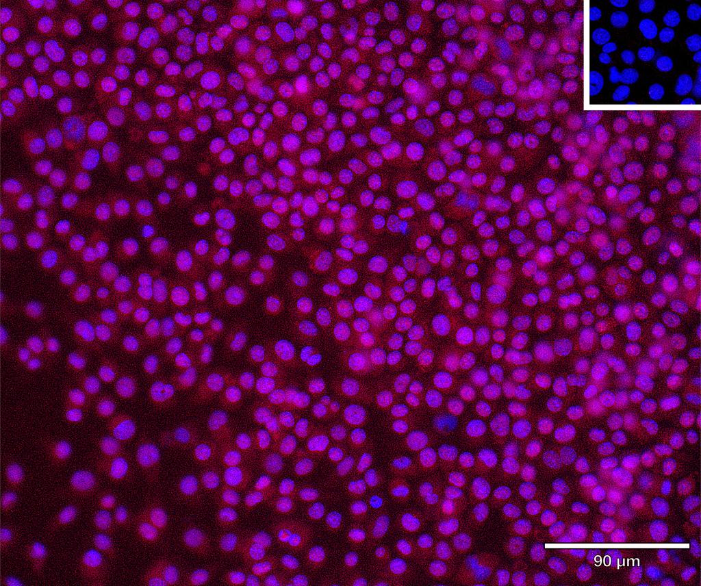 Ankyron DLL1_MOUSE Clone CF30177