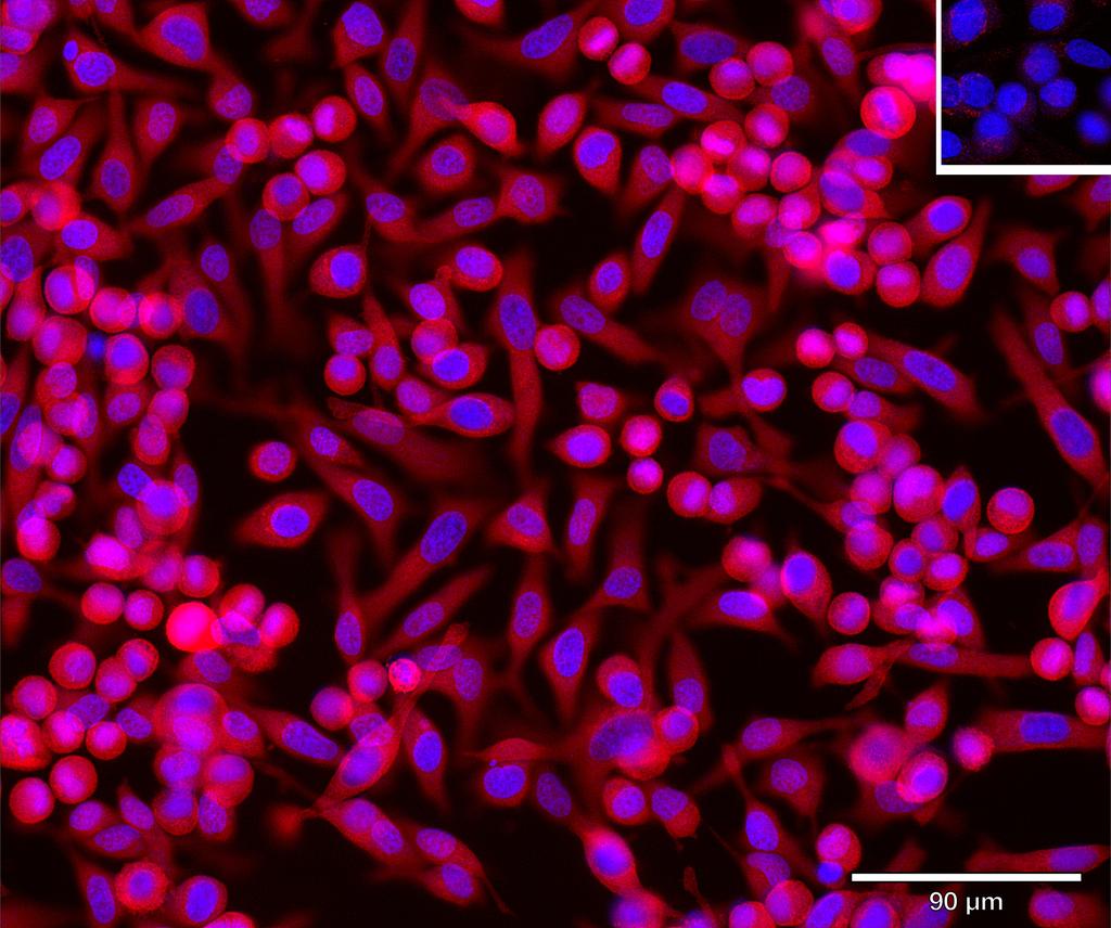 Ankyron DPEP2_HUMAN Clone CW40892