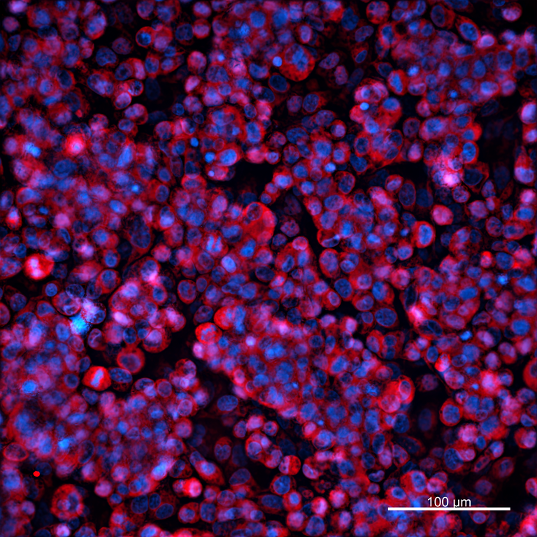 Ankyron DSG2_HUMAN Clone FK40169