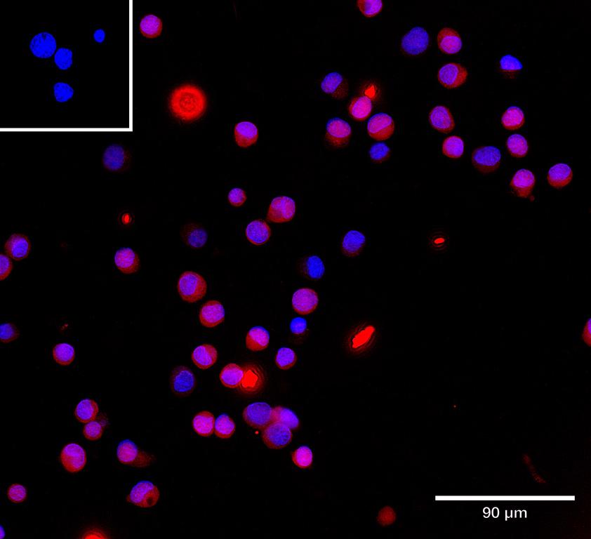 Ankyron DUS3_HUMAN Clone FE40625