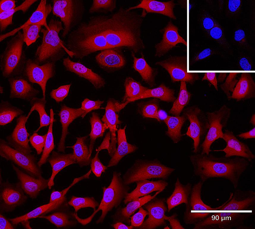 Ankyron ECE1_HUMAN Clone AT30150