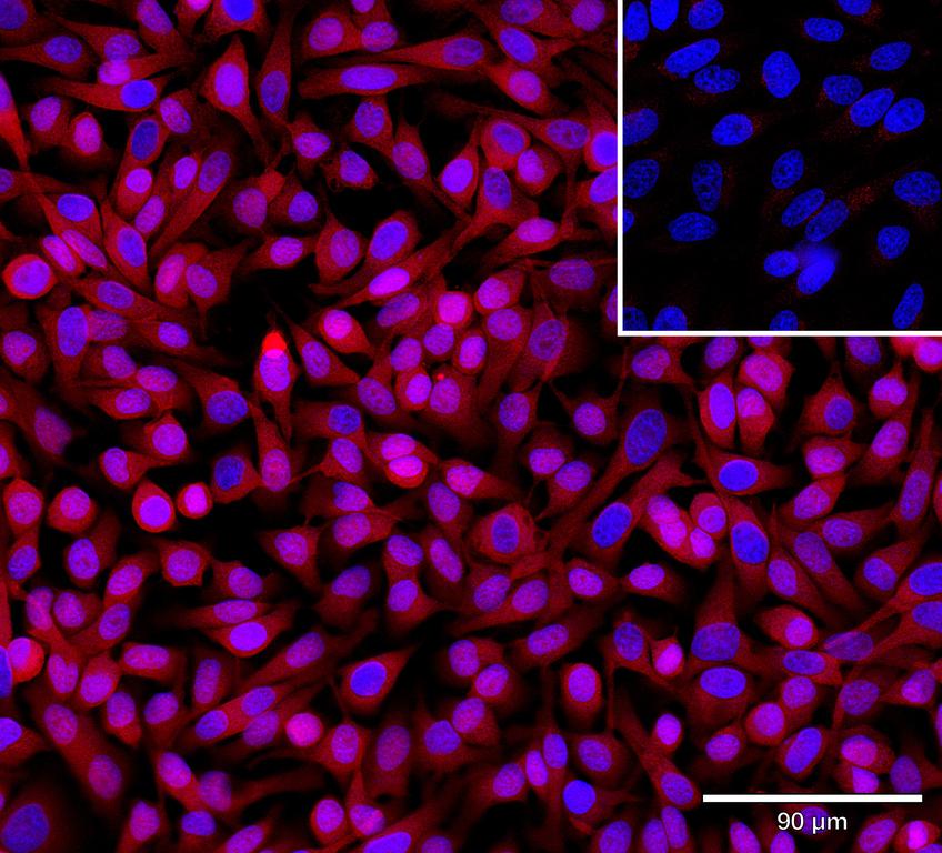 Ankyron EFNA4_HUMAN Clone AR40119