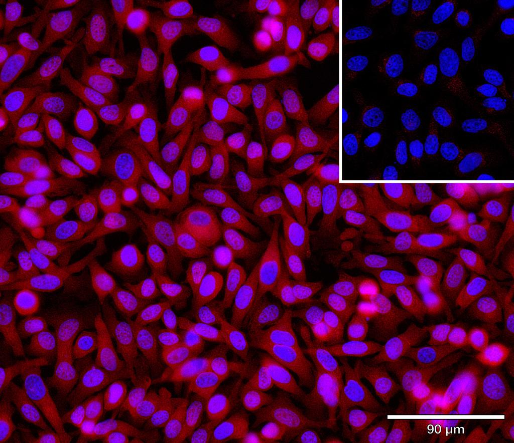 Ankyron EFNA4_HUMAN Clone AR40124