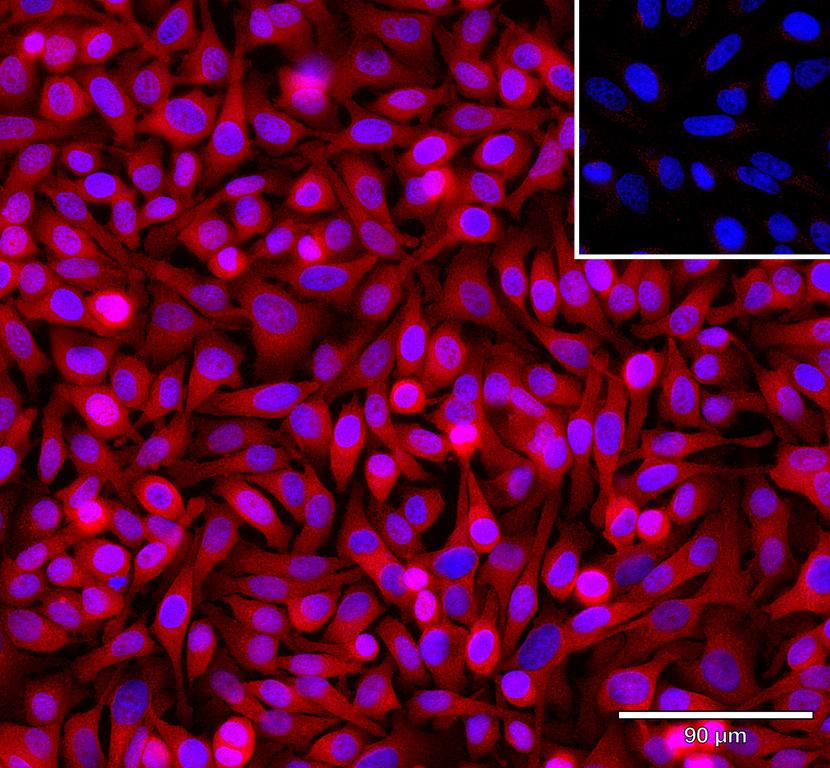 Ankyron EFNA4_HUMAN Clone AR40126