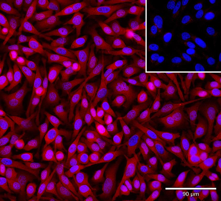 Ankyron EFNA4_HUMAN Clone AR40127
