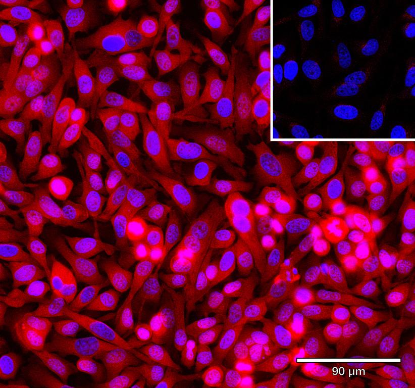 Ankyron EFNA4_HUMAN Clone AR40129