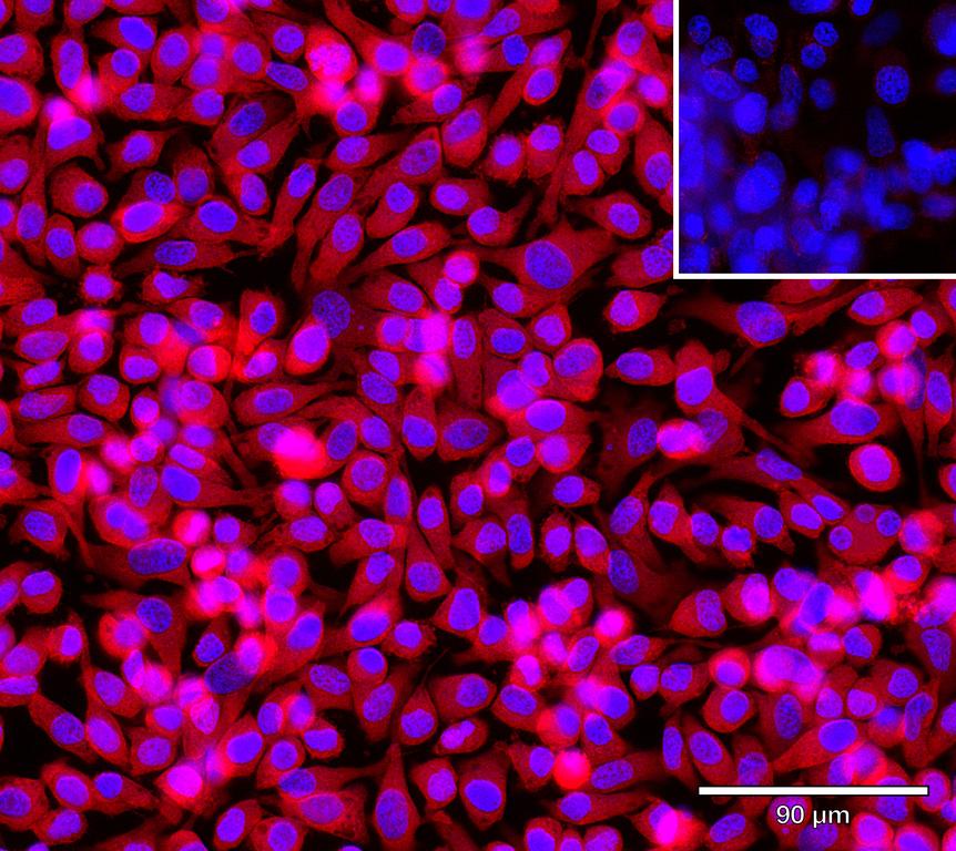 Ankyron EFNA5_HUMAN Clone AH50160