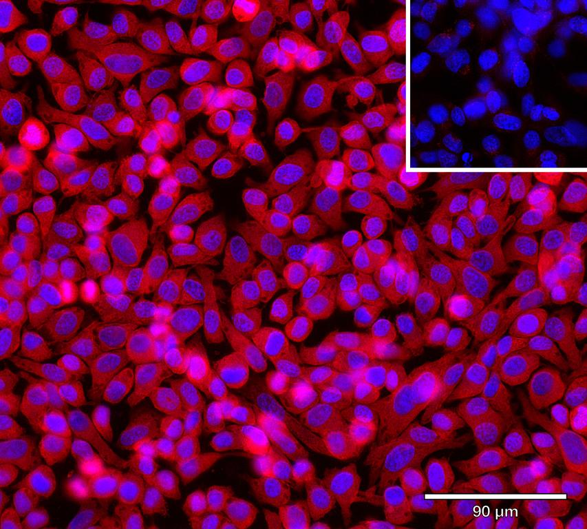 Ankyron EFNA5_HUMAN Clone AH50163
