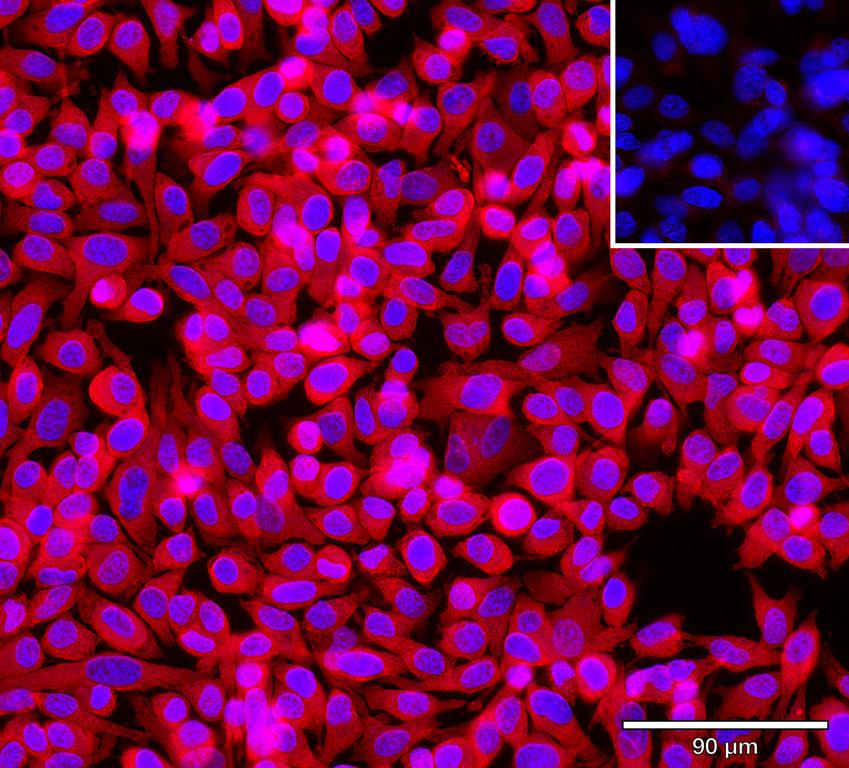 Ankyron EFNA5_HUMAN Clone BZ31049