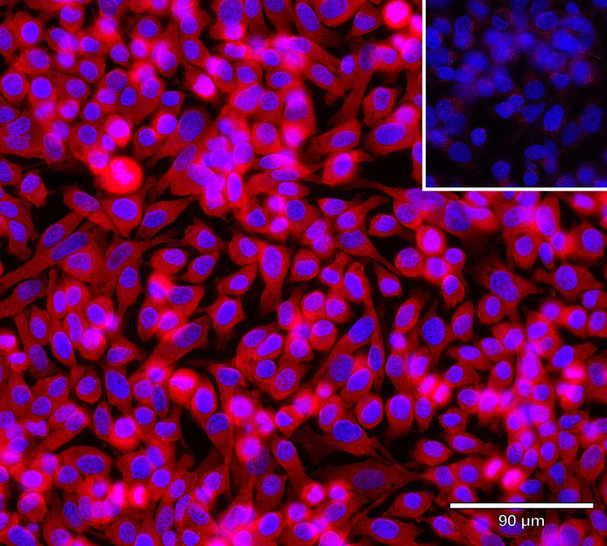 Ankyron EFNA5_HUMAN Clone AH50162