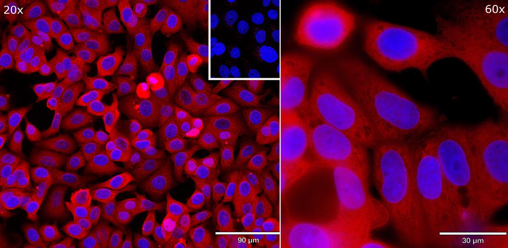 Ankyron EGF_HUMAN Clone AB40685