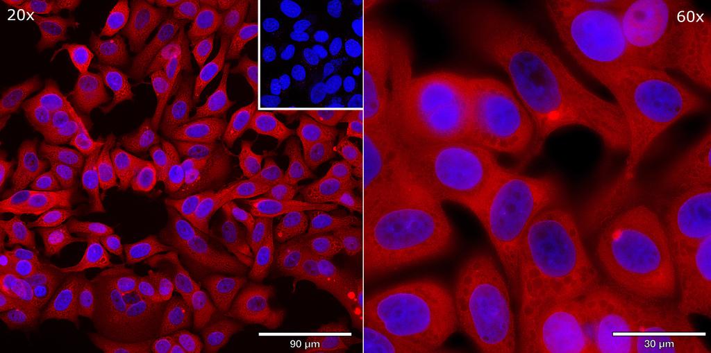 Ankyron EGF_HUMAN Clone AB40686