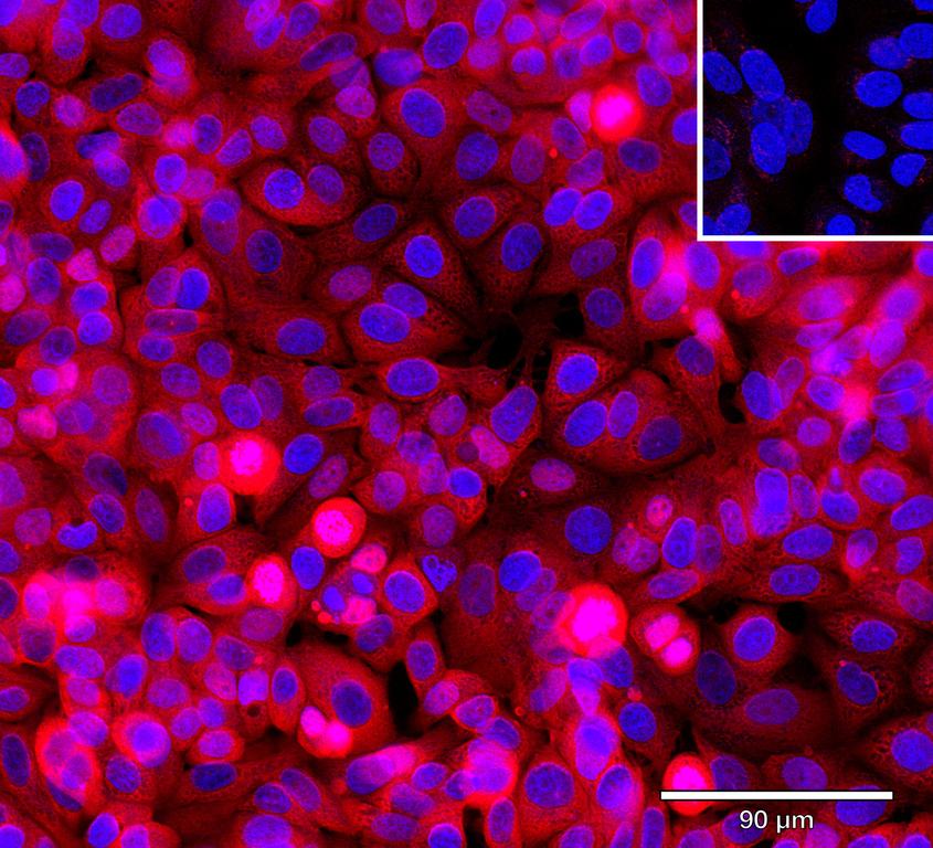 Ankyron EGF_HUMAN Clone AB40683