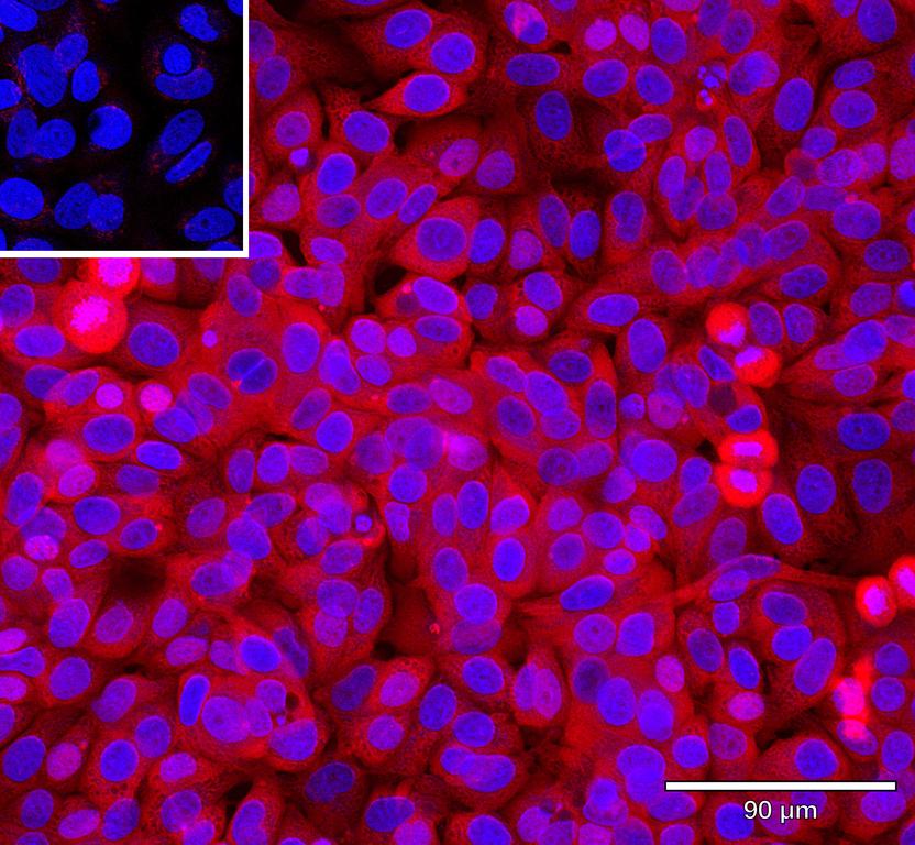 Ankyron EGF_HUMAN Clone AB40687