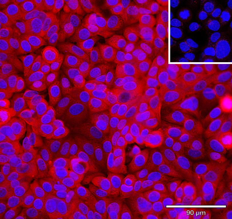 Ankyron EGF_HUMAN Clone AB40690