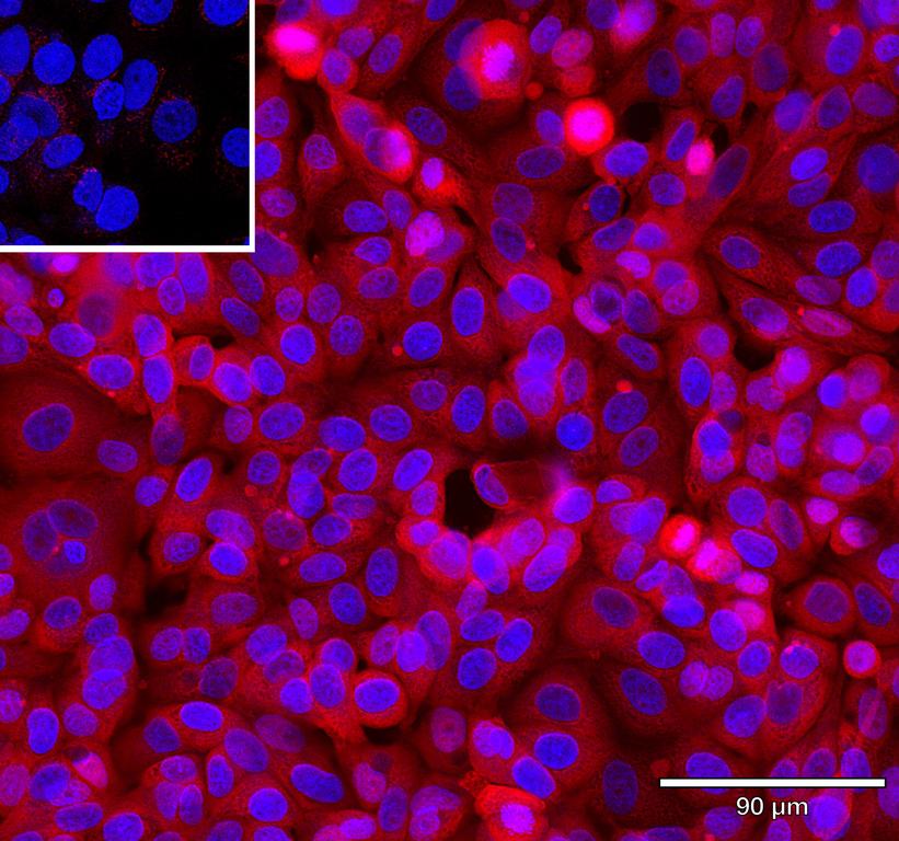 Ankyron EGF_HUMAN Clone AB40681