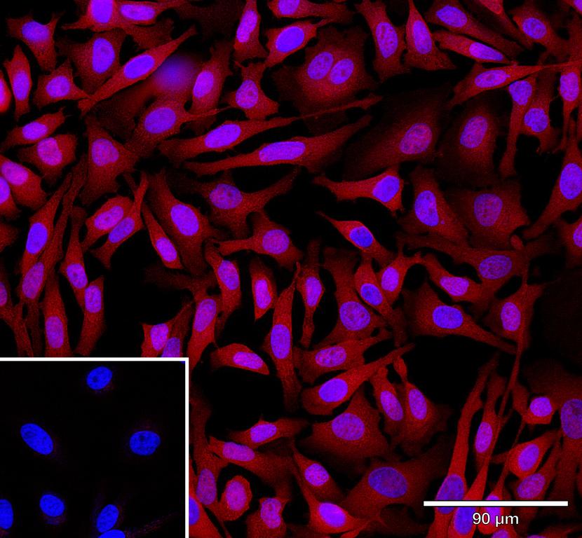 Ankyron ENOB_HUMAN Clone AZ40849