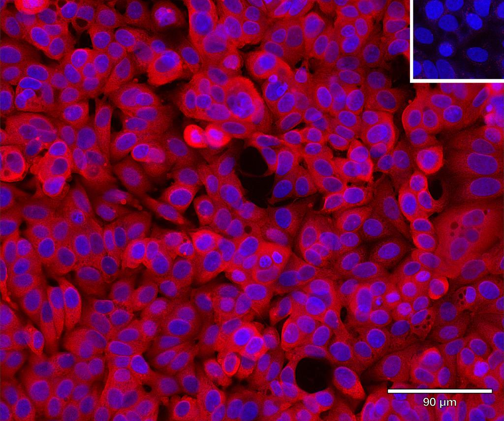 Ankyron ENPP5_HUMAN Clone AH50263