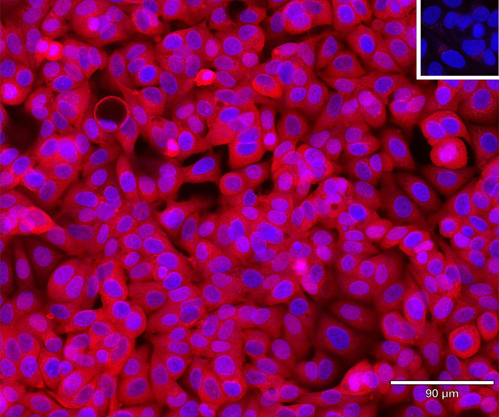 Ankyron ENPP5_HUMAN Clone AH50264