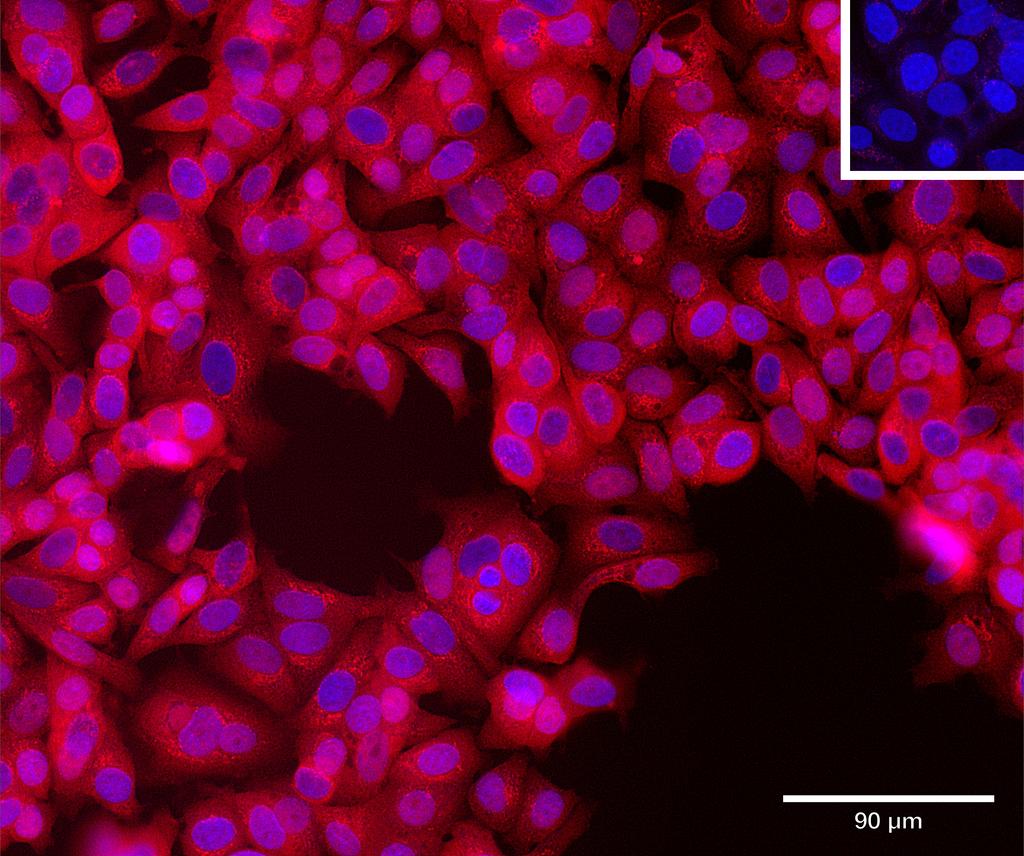 Ankyron ENPP5_HUMAN Clone AH50265