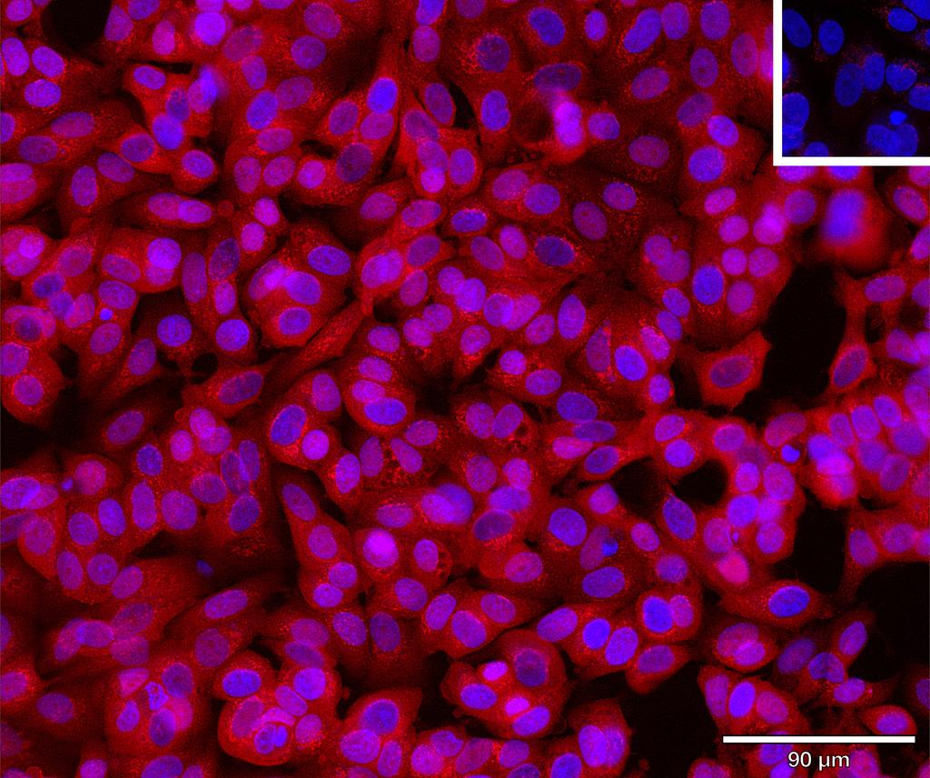 Ankyron ENPP5_HUMAN Clone AH50266