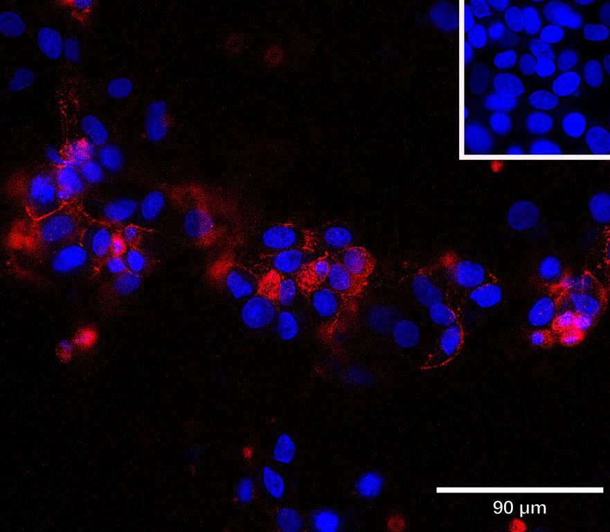 Ankyron EPHB4_HUMAN Clone CL40405