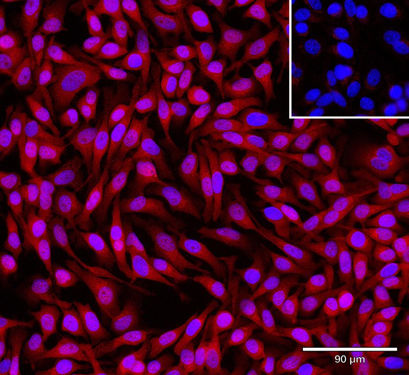 Ankyron ERP44_HUMAN Clone AL40118