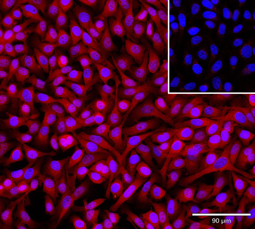 Ankyron ERP44_HUMAN Clone AL40119