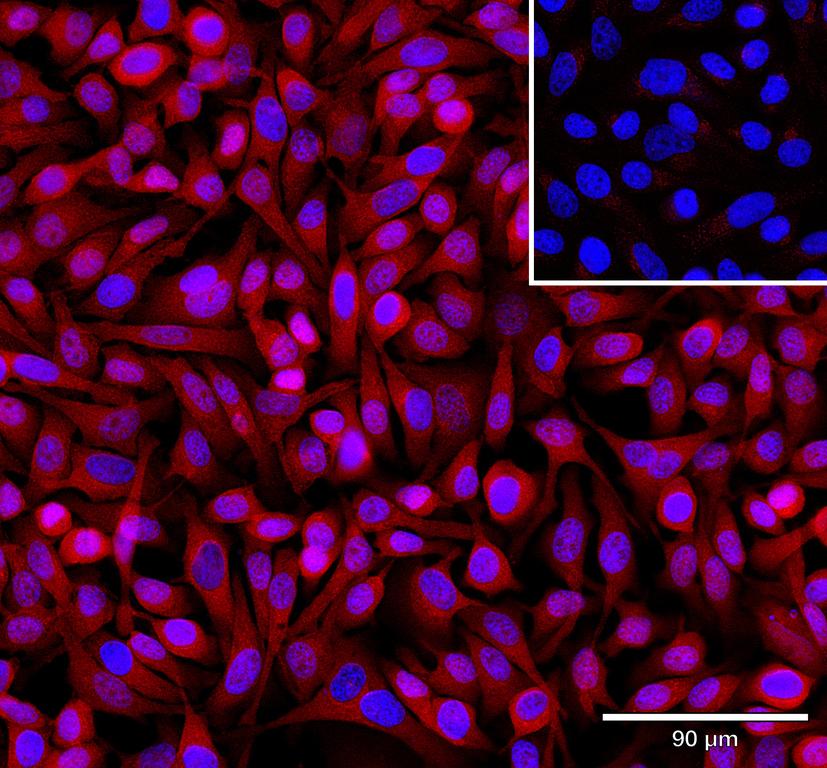 Ankyron ERP44_HUMAN Clone AL40120