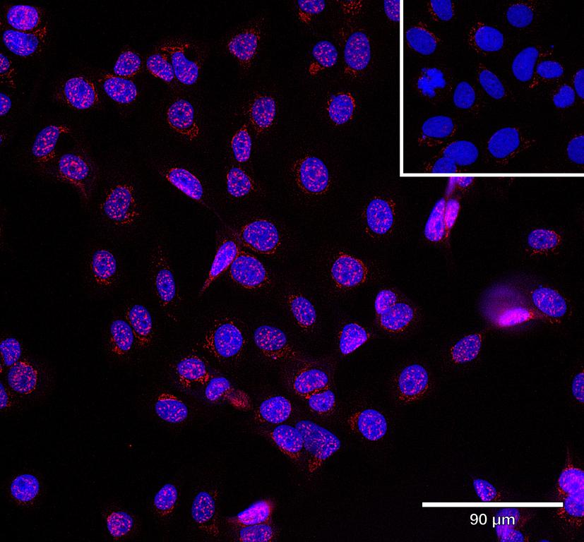 Ankyron ESR2_HUMAN Clone CQ40360