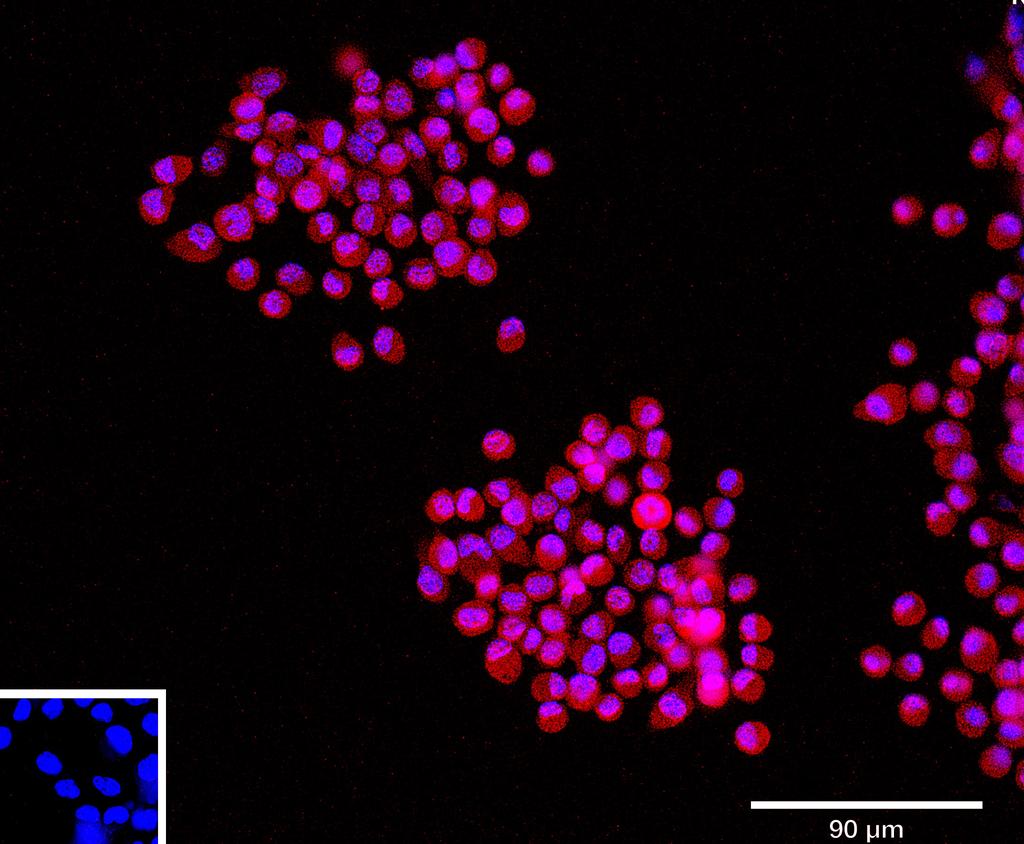 Ankyron EST1_MOUSE Clone CV40786