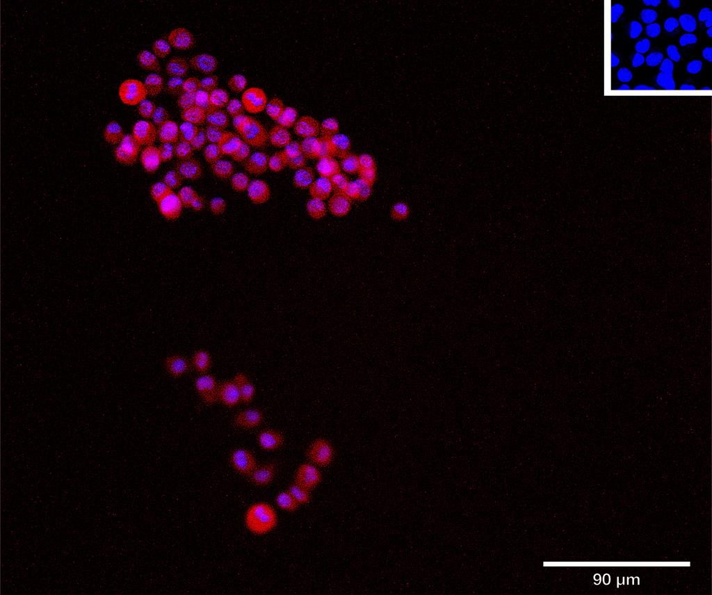 Ankyron EST1_MOUSE Clone CV40787