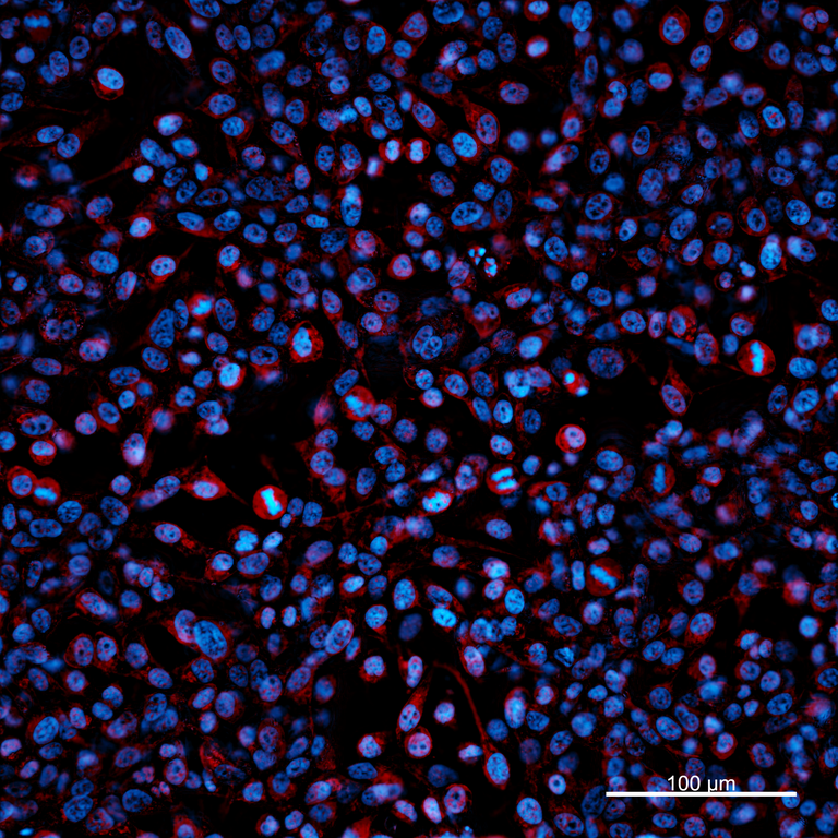 Ankyron EXOS3_HUMAN Clone FN40965