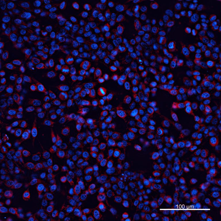 Ankyron EXOS3_HUMAN Clone FN40962