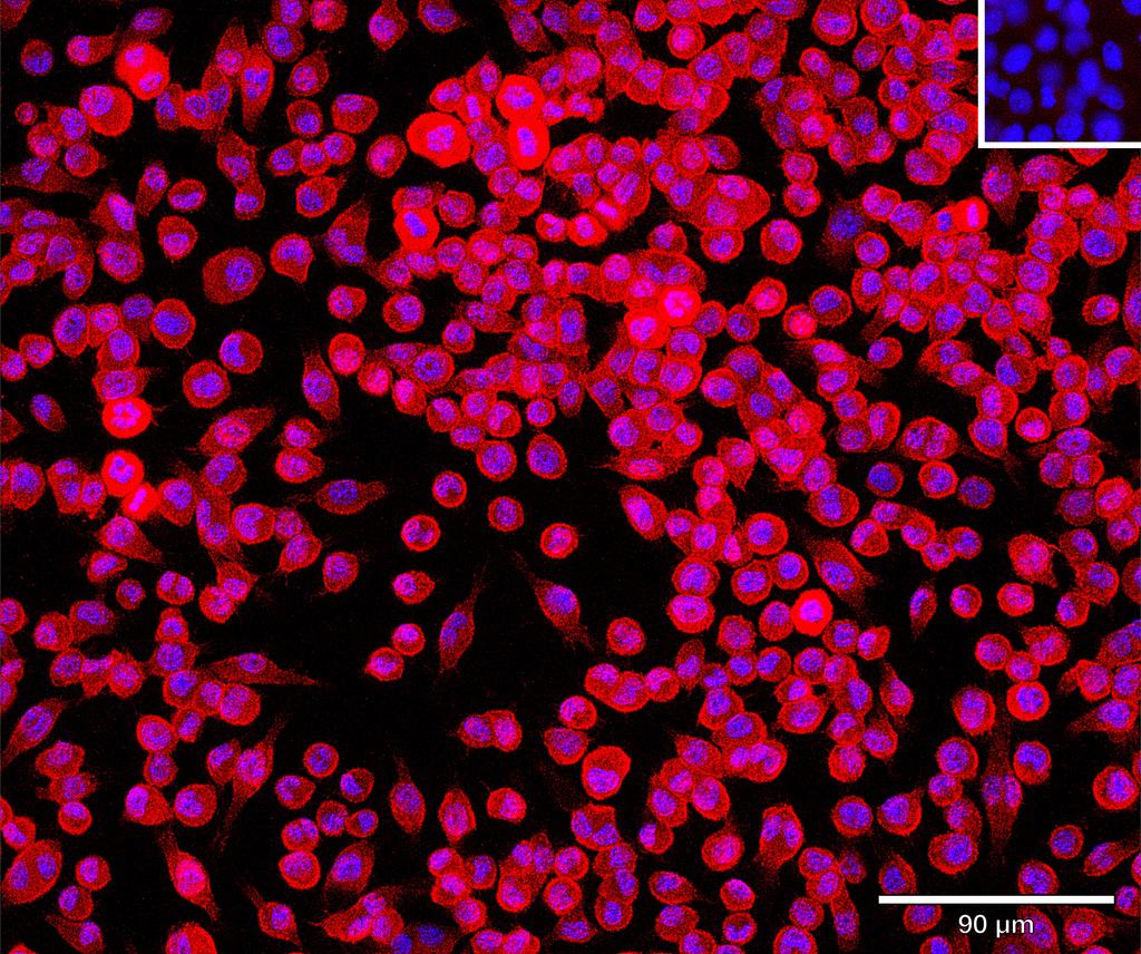 Ankyron F8WHB7_MOUSE Clone CV40365