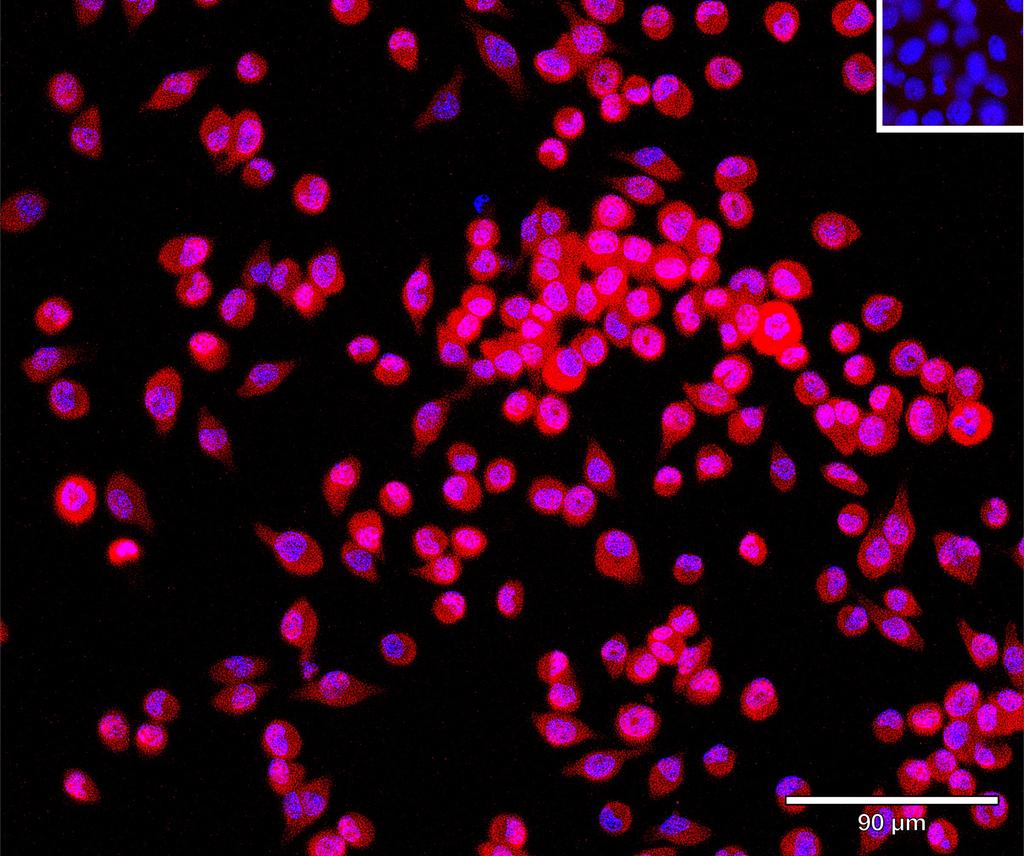 Ankyron F8WHB7_MOUSE Clone CV40348