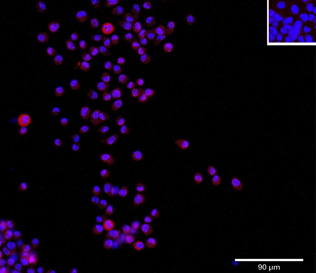 Ankyron F8WHB7_MOUSE Clone CV40354