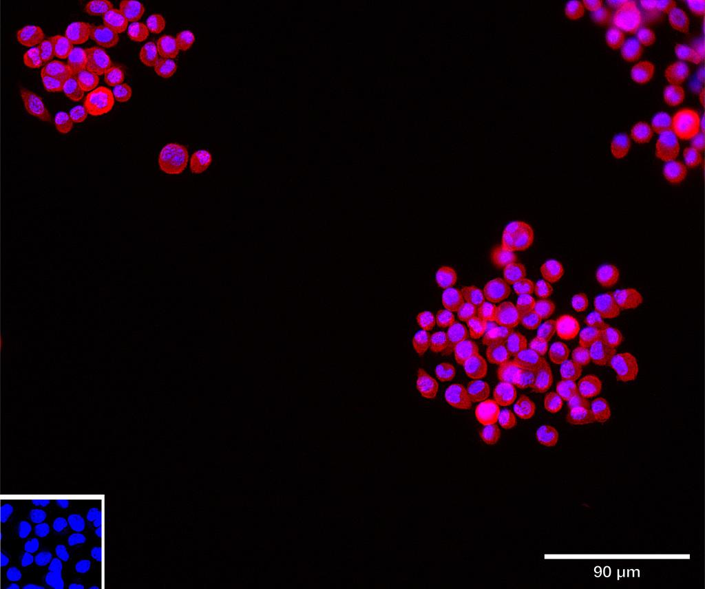 Ankyron F8WHB7_MOUSE Clone CV40345