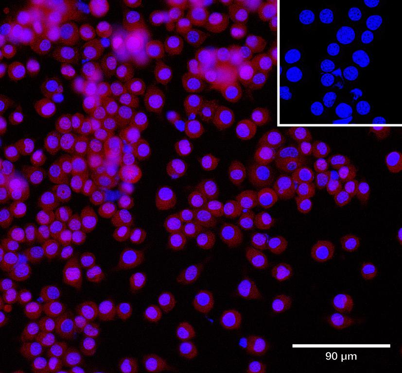 Ankyron F8WHB7_MOUSE Clone CV40359