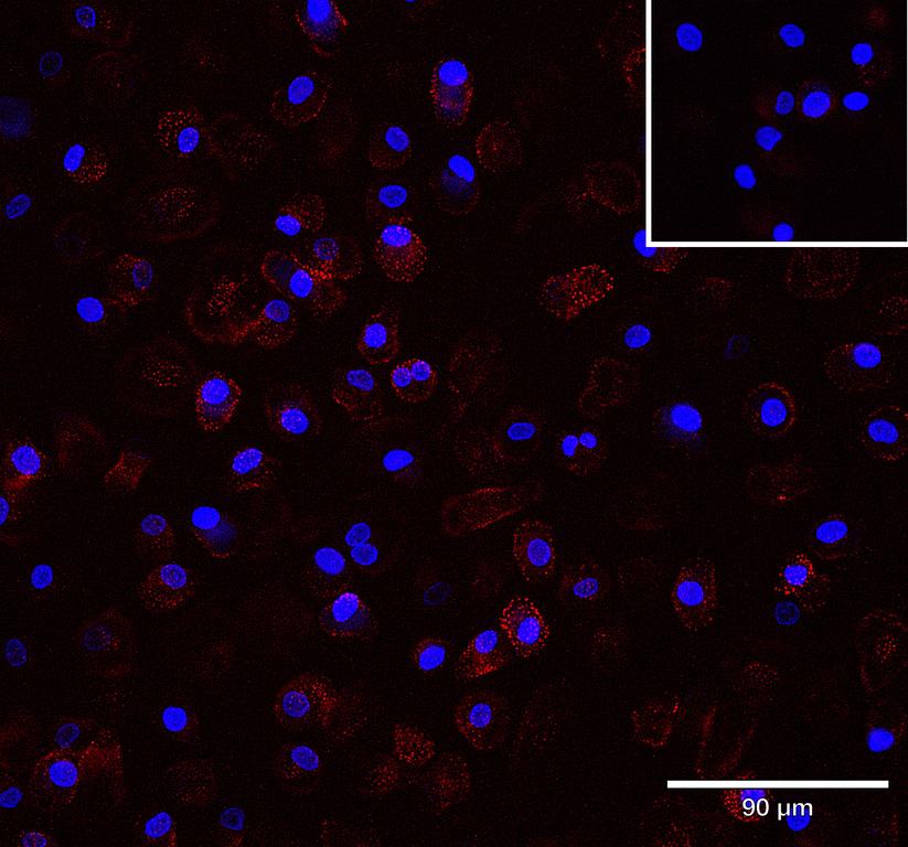 Ankyron FCG2B_HUMAN Clone AU41160