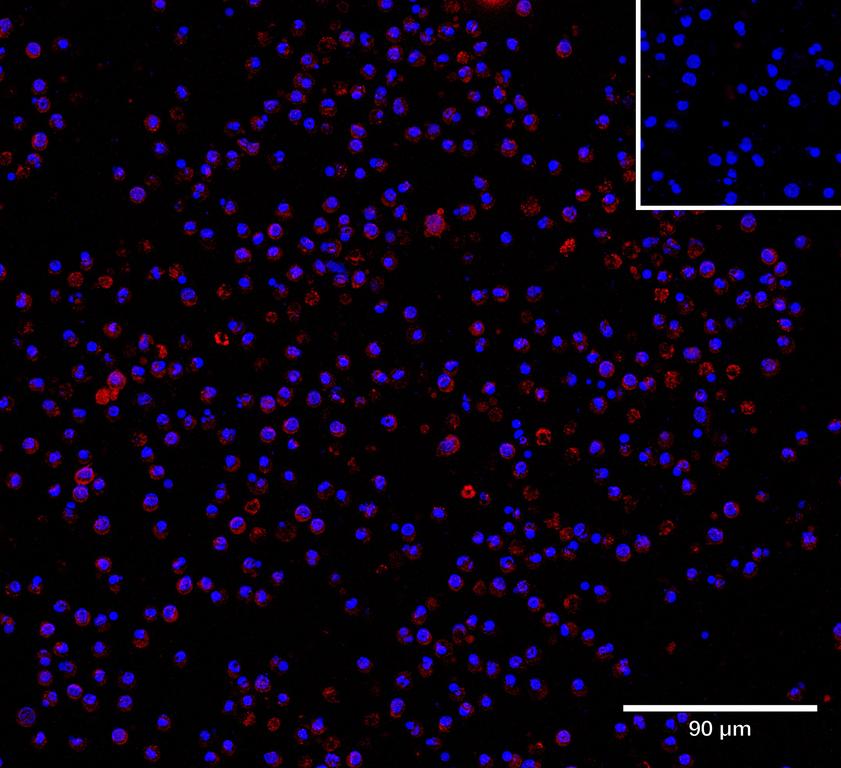 Ankyron FCG2C_HUMAN Clone DR40349