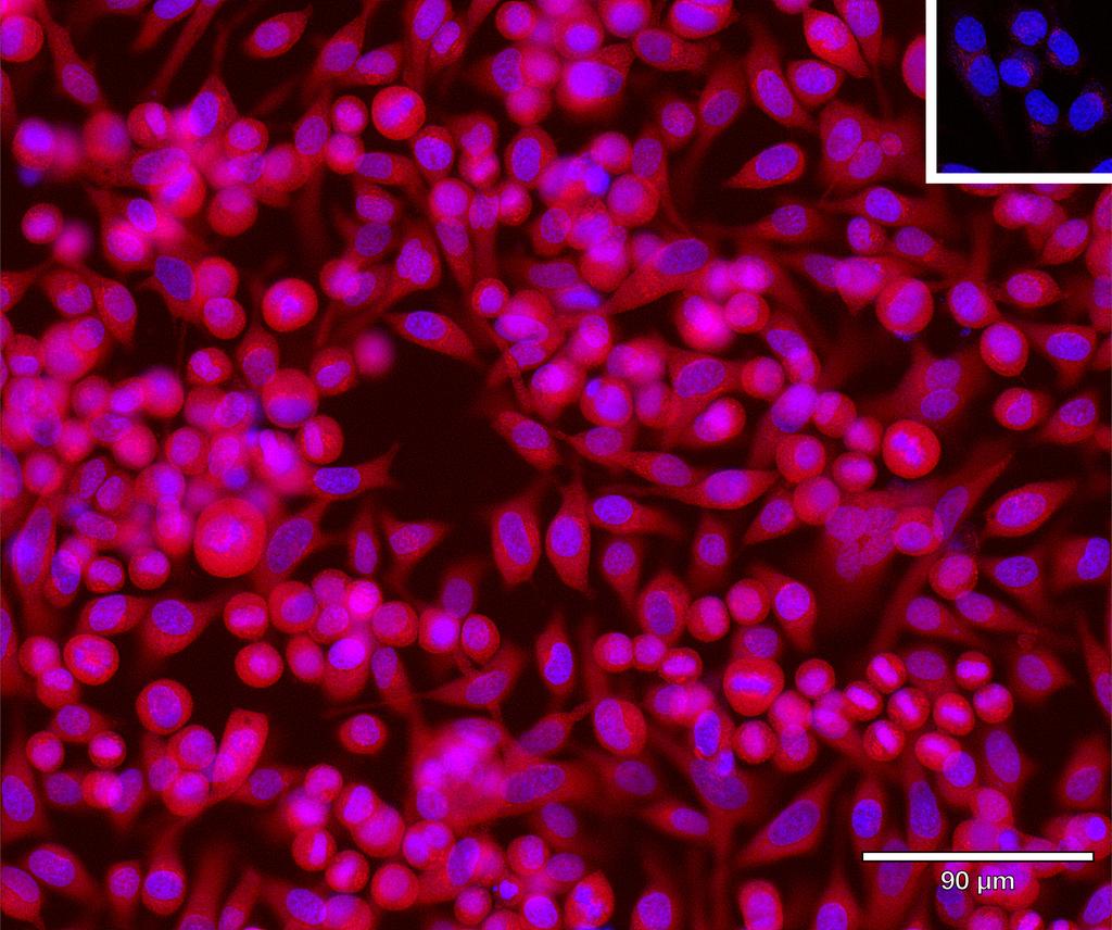 Ankyron FCRL2_HUMAN Clone BA40183