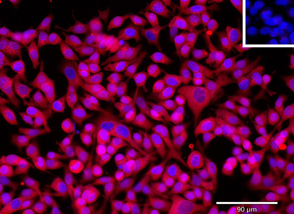 Ankyron FCRL2_HUMAN Clone BA40179