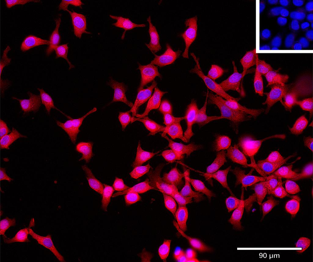 Ankyron FCRL2_HUMAN Clone BA40178