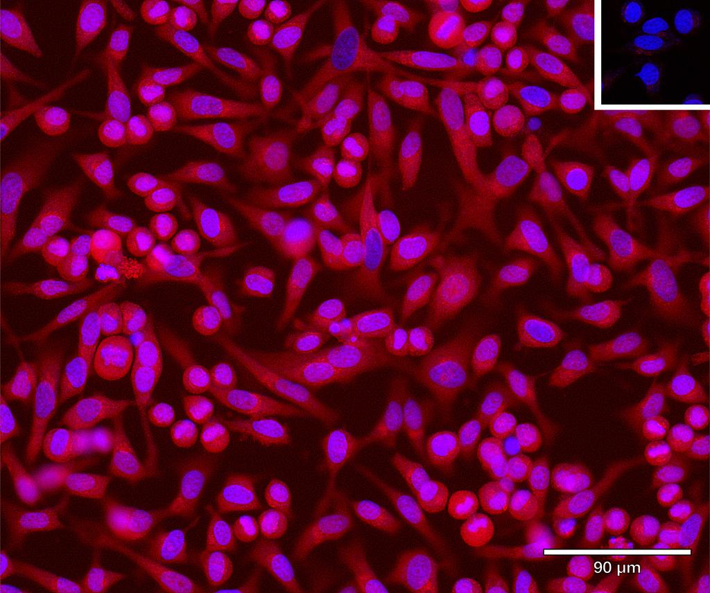 Ankyron FCRL2_HUMAN Clone BA40176