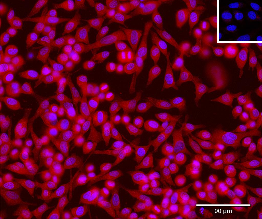 Ankyron FCRL2_HUMAN Clone BA40177