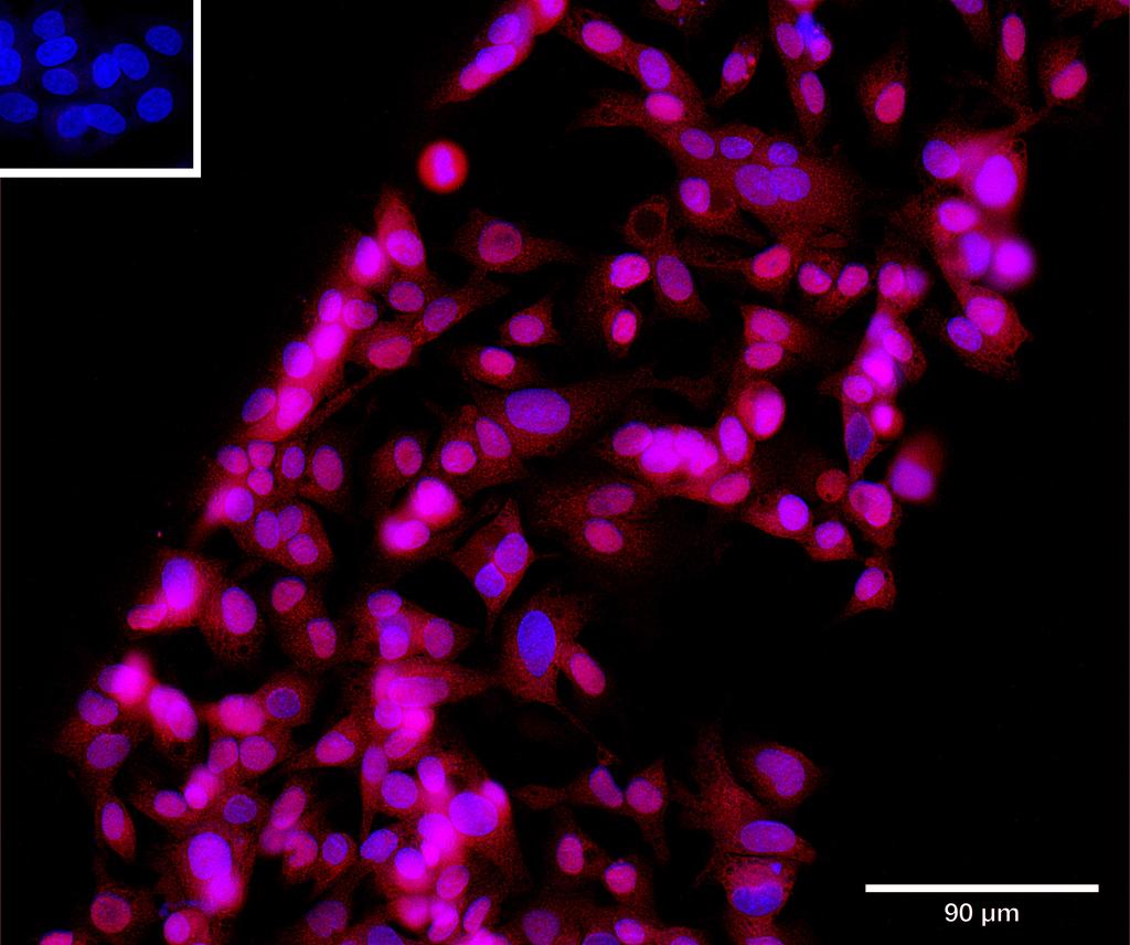 Ankyron FGF23_HUMAN Clone BV40881